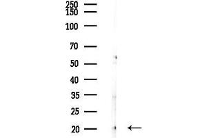 anti-Glycoprotein M6B (GPM6B) (N-Term) antibody
