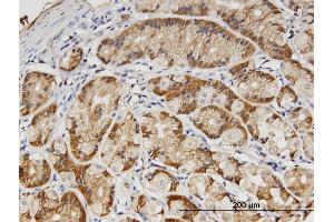 Immunoperoxidase of monoclonal antibody to PVRL3 on formalin-fixed paraffin-embedded human stomach. (nectin-3 Antikörper  (AA 59-166))