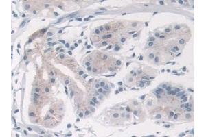 Detection of TRPC6 in Human Stomach Tissue using Polyclonal Antibody to Transient Receptor Potential Cation Channel Subfamily C, Member 6 (TRPC6)