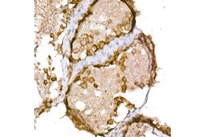 Immunohistochemistry of paraffin-embedded human testis using NY-ESO-1 Rabbit pAb (ABIN6129965, ABIN6139172, ABIN6139173 and ABIN6225112) at dilution of 1:150 (40x lens). (CTAG1B Antikörper  (AA 1-180))