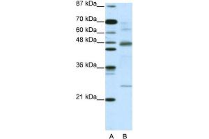 WB Suggested Anti-NFKBIB Antibody Titration:  5. (NFKBIB Antikörper  (C-Term))