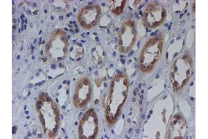 Immunohistochemistry (IHC) image for anti-Chromosome 21 Open Reading Frame 56 (C21orf56) antibody (ABIN1497041) (C21ORF56 Antikörper)
