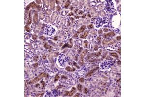 IHC testing of FFPE mouse kidney tissue with PDGFRB antibody at 2 ug/ml. (PDGFRB Antikörper  (AA 911-992))