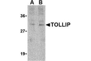 Western blot analysis of TOLLIP in rat brain cell lysate with this product at (A) 1 and (B) 2 μg/ml. (TOLLIP Antikörper  (C-Term))