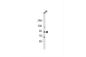Anti-CRI Antibody at 1:1000 dilution + Hela whole cell lysates Lysates/proteins at 20 μg per lane. (RASA4 Antikörper)