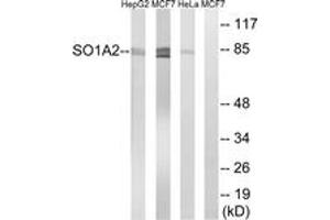 Western blot analysis of extracts from HeLa/MCF-7/HepG2 cells, using SLCO1A2 Antibody. (SLCO1A2 Antikörper  (AA 251-300))