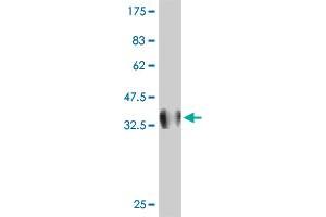 Western Blotting (WB) image for anti-Integrin, alpha E (Antigen CD103, Human Mucosal Lymphocyte Antigen 1, alpha Polypeptide) (ITGAE) (AA 57-171) antibody (ABIN517247)