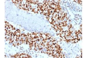 ABIN6383795 to Cyclin E1 was successfully used to stain nuclei in human colon carcinoma sections.