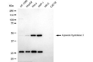 Western blotting analysis using epoxide hydrolase 1 antibody (ABIN7798484). (EPHX1 Antikörper)