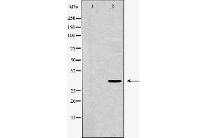 Western blot analysis of HeLa whole cell lysate, using POLR2C Antibody.