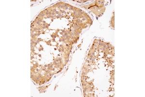 Immunohistochemical analysis of (ABIN391446 and ABIN2841429) on paraffin-embedded human testis tissue was performed on the Leica®BOND RXm. (SPAG9 Antikörper  (N-Term))