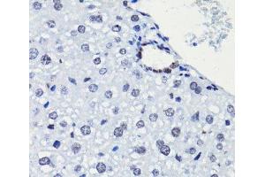 Immunohistochemistry of paraffin-embedded Mouse liver using Acetyl-Histone H2A-K5 Polyclonal Antibody at dilution of 1:100 (40x lens). (Histone H2A Antikörper  (acLys5))