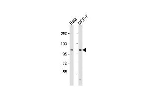 All lanes : Anti-VLDLR Antibody (C-Term) at 1:2000 dilution Lane 1: Hela whole cell lysate Lane 2: MCF-7 whole cell lysate Lysates/proteins at 20 μg per lane. (VLDLR Antikörper  (AA 608-642))