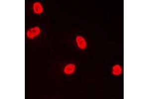 Immunofluorescent analysis of TFDP1 staining in A431 cells.