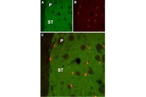 Expression of Muscarinic acetylcholine receptor M1 in rat striatumImmunohistochemical staining of rat striatum (ST) using Anti-CHRM1 Antibody (ABIN7043060, ABIN7044580 and ABIN7044581). (Muscarinic Acetylcholine Receptor M1 (CHRM1) Peptid)