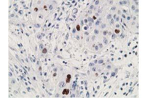 Image no. 2 for anti-Tumor Protein P53 (TP53) antibody (ABIN1499968) (p53 Antikörper)