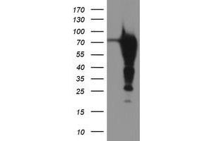 Western Blotting (WB) image for anti-Epsin 2 (EPN2) antibody (ABIN1498053) (Epsin 2 Antikörper)