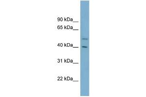 WB Suggested Anti-B4GALT2 Antibody Titration:  0.