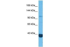 Host:  Rabbit  Target Name:  HDAC4  Sample Tissue:  Human MCF7 Whole Cell  Antibody Dilution:  1ug/ml (HDAC4 Antikörper  (Middle Region))