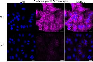 Immunocytochemical staining of HepG2 cells using Epidermal growth factor receptor antibody (ABIN7798478), 1:1,000), Top panel: wild-type (WT), Bottom panal: Adiponectin receptor 1 shRNA knockdown (KD). (Rekombinanter EGFR Antikörper)