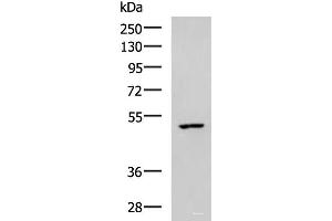 Western blot analysis of MCF7 cell lysate using CKMT1A/CKMT1B Polyclonal Antibody at dilution of 1:600 (CKMT1 Antikörper)