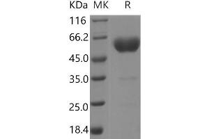 Western Blotting (WB) image for Podoplanin (PDPN) protein (Fc Tag,ECD) (ABIN7197420) (Podoplanin Protein (PDPN) (Fc Tag,ECD))