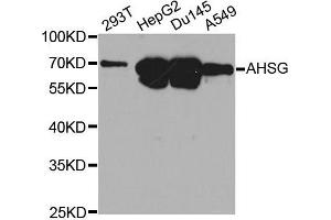 Western blot analysis of extracts of various cell lines, using AHSG antibody. (Fetuin A Antikörper  (AA 19-300))