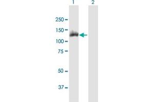 Western Blot analysis of ACLY expression in transfected 293T cell line by ACLY MaxPab polyclonal antibody. (ACLY Antikörper  (AA 1-1101))