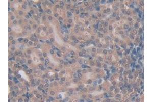 Immunohistochemistry (IHC) image for anti-Pro-Platelet Basic Protein (Chemokine (C-X-C Motif) Ligand 7) (PPBP) (AA 46-107) antibody (ABIN7431665)