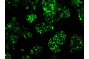 Image no. 14 for anti-Replication Protein A2, 32kDa (RPA2) antibody (ABIN1500736)