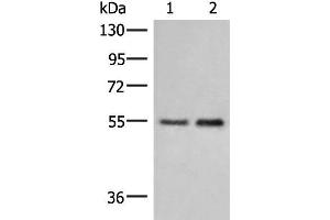 Western blot analysis of Human placenta tissue and 231 cell lysates using HTRA4 Polyclonal Antibody at dilution of 1:400 (HTRA4 Antikörper)