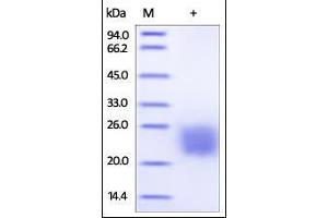 Biotinylated Cynomolgus CTLA-4 on SDS-PAGE under reducing (R) condition. (CTLA4 Protein (AA 37-160) (His tag,AVI tag,Biotin))