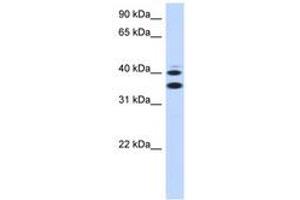 Image no. 1 for anti-Solute Carrier Family 25, Member 32 (SLC25A32) (AA 215-264) antibody (ABIN6743231) (SLC25A32 Antikörper  (AA 215-264))
