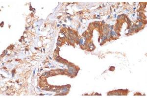 Immunohistochemistry of paraffin-embedded Human lung using HHLA2 Polyclonal Antibody at dilution of 1:100 (40x lens). (HHLA2 Antikörper)