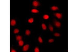 Immunofluorescent analysis of Histone H4 (AcK12) staining in A431 cells. (Histone H4 Antikörper  (acLys12, N-Term))