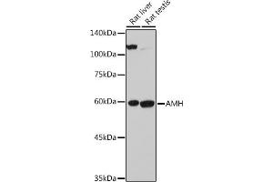 Western blot analysis of extracts of various cell lines, using AMH antibody (ABIN7265629) at 1:500 dilution. (AMH Antikörper  (AA 20-280))