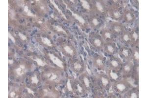 DAB staining on IHC-P; Samples: Rat Kidney Tissue (Rhotekin Antikörper  (AA 296-548))