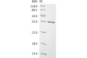 (Tris-Glycine gel) Discontinuous SDS-PAGE (reduced) with 5 % enrichment gel and 15 % separation gel.