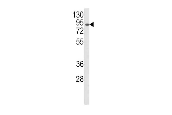 AOC3 Antikörper  (AA 613-640)