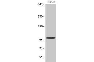 Western Blotting (WB) image for anti-Vav 2 Guanine Nucleotide Exchange Factor (VAV2) (Tyr299) antibody (ABIN3177911) (VAV2 Antikörper  (Tyr299))
