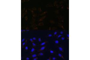 Immunofluorescence analysis of U-2 OS cells using IL13R antibody (ABIN7267987) at dilution of 1:100. (IL13RA2 Antikörper)