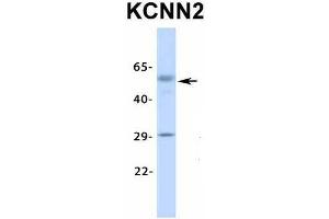 Host:  Rabbit  Target Name:  KCNN2  Sample Type:  Human Fetal Lung  Antibody Dilution:  1. (KCNN2 Antikörper  (Middle Region))