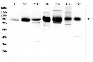 Western blot analysis of ICAM1 using anti-ICAM1 antibody (ABIN5692991). (ICAM1 Antikörper  (AA 28-268))