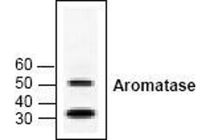 Image no. 1 for anti-Cytochrome P450, Family 19, Subfamily A, Polypeptide 1 (CYP19A1) antibody (ABIN126953) (Aromatase Antikörper)