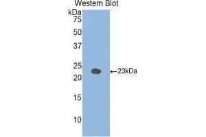 Western blot analysis of the recombinant protein. (GAA Antikörper  (AA 755-953))