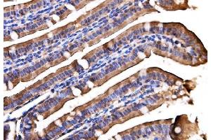 IHC analysis of AGPAT2 using anti-AGPAT2 antibody (ABIN7602435). (AGPAT2 Antikörper  (AA 77-178))