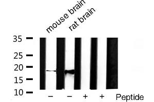 Western blot analysis of SOD1 Antibody expression in rat brain and mouse brain tissues lysates. (SOD1 Antikörper  (Internal Region))