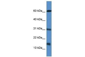 Western Blot showing CARD17 antibody used at a concentration of 1 ug/ml against Jurkat Cell Lysate (CARD17 Antikörper  (Middle Region))