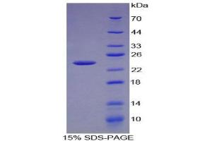 SDS-PAGE (SDS) image for Chemokine (C-X-C Motif) Ligand 15 (CXCL15) (AA 26-167) protein (His tag) (ABIN1170060)
