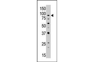 The ABCB7 polyclonal antibody  is used in Western blot to detect ABCB7 in Jurkat cell lysate. (ABCB7 Antikörper  (C-Term))